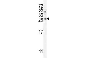 Western Blotting (WB) image for anti-Betacellulin (BTC) antibody (ABIN2996306) (Betacellulin 抗体)