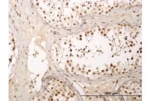Immunoperoxidase of monoclonal antibody to ZNF213 on formalin-fixed paraffin-embedded human testis. (ZNF213 抗体  (AA 133-242))