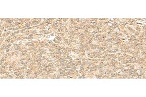 Immunohistochemistry of paraffin-embedded Human tonsil tissue using ENSA Polyclonal Antibody at dilution of 1:40(x200) (Ensa 抗体)