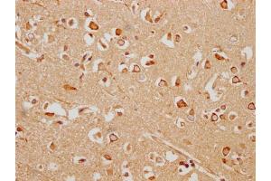 IHC image of ABIN7154933 diluted at 1:200 and staining in paraffin-embedded human brain tissue performed on a Leica BondTM system. (HHIP 抗体  (AA 183-424))