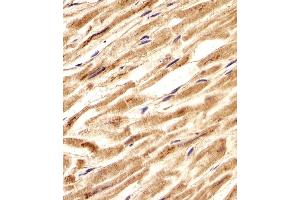 Immunohistochemical analysis of paraffin-embedded H. (CNBP 抗体  (AA 91-118))