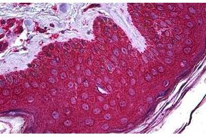 Human Skin: Formalin-Fixed, Paraffin-Embedded (FFPE) (ABHD5 抗体  (AA 1-350))