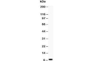 Western blot testing of Defensin 1 antibody at and COLO320 lysate;  Predicted size: 7KD;  Observed size: 7KD (beta Defensin 1 抗体  (C-Term))