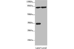 Western blot All lanes: MTO1 antibody at 4. (MTO1 抗体  (AA 420-680))