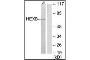 Western blot analysis of extracts from Jurkat cells using HEXB Antibody . (HEXB 抗体  (C-Term))