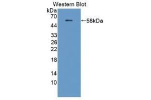 Amyloid beta (A4) Precursor Protein-Binding, Family B, Member 1 Interacting Protein (APBB1IP) (AA 188-421) Antikörper