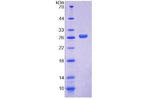 SDS-PAGE analysis of Human LRP1B Protein. (LRP1B 蛋白)