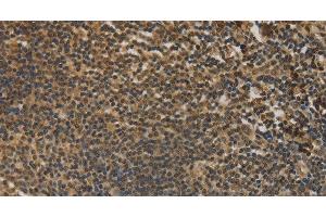 Immunohistochemistry of paraffin-embedded Human tonsil tissue using DACH1 Polyclonal Antibody at dilution 1:50 (DACH1 抗体)