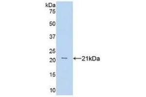 WB of Protein Standard: different control antibodies against Highly purified E. (TNF alpha ELISA 试剂盒)