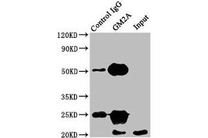 Immunoprecipitating GM2A in HEK293 whole cell lysate Lane 1: Rabbit control IgG instead of ABIN7153574 in HEK293 whole cell lysate. (GM2A 抗体  (AA 32-193))