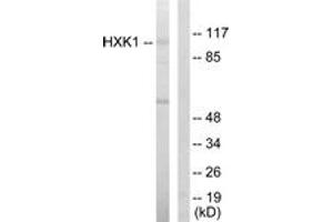 Western blot analysis of extracts from HeLa cells, using HXK1 Antibody. (Hexokinase 1 抗体  (AA 31-80))