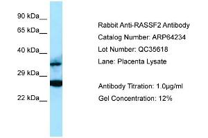 Western Blotting (WB) image for anti-Ras Association (RalGDS/AF-6) Domain Family Member 2 (RASSF2) (C-Term) antibody (ABIN971538) (RASSF2 抗体  (C-Term))