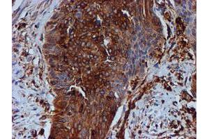 Image no. 1 for anti-Tubulin beta 4a (TUBB4A) antibody (ABIN1501579) (TUBB4 抗体)
