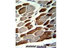 Immunohistochemistry (IHC) image for anti-Elastin Microfibril Interfacer 1 (EMILIN1) antibody (ABIN3002724) (Emilin1 抗体)