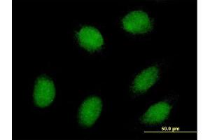 Immunofluorescence of purified MaxPab antibody to EXOSC1 on HeLa cell. (EXOSC1 抗体  (AA 1-195))