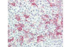 Formalin-fixed and paraffin-embedded H. (IFNA4 抗体  (C-Term))