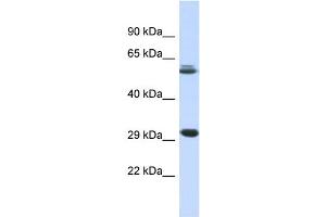 Host:  Rabbit  Target Name:  PCGF3  Sample Type:  Fetal Muscle lysates  Antibody Dilution:  1. (PCGF3 抗体  (Middle Region))