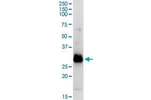 Western Blotting (WB) image for anti-Oligodendrocyte Transcription Factor 1 (OLIG1) (AA 1-255) antibody (ABIN949817)