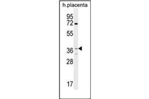 Western Blotting (WB) image for anti-Olfactory Receptor, Family 2, Subfamily AT, Member 4 (OR2AT4) (AA 6-35), (C-Term) antibody (ABIN953835)