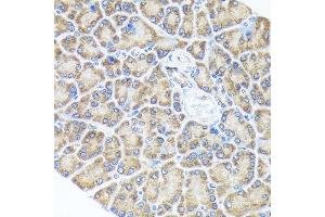 Immunohistochemistry of paraffin-embedded rat pancreas using Sprouty 2 Rabbit mAb (ABIN7270554) at dilution of 1:100 (40x lens).