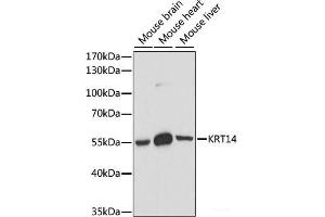 Western blot analysis of extracts of various cell lines using KRT14 Polyclonal Antibody at dilution of 1:1000. (KRT14 抗体)