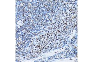 Immunohistochemistry of paraffin-embedded rat spleen using Histone H3 Rabbit mAb (ABIN7267705) at dilution of 1:100 (40x lens). (HIST1H3A 抗体)