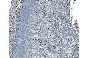 IHC analysis of SND1 using anti-SND1 antibody (ABIN7600526). (SND1 抗体  (AA 20-204))