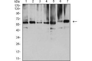 Western blot analysis using NAA10 mouse mAb against COS7 (1), HEK293 (2), HL-60 (3), MCF-7 (4), Hela (5), NIH/3T3 (6), and C2C12 (7) cell lysate. (NAA10 抗体  (AA 111-235))