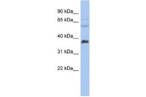 RALY antibody used at 1 ug/ml to detect target protein. (Raly 抗体  (Middle Region))