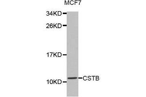Western blot analysis of extracts of MCF7 cell lines, using CSTB antibody. (CSTB 抗体  (AA 1-98))