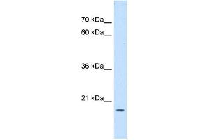 WB Suggested Anti-ASF1B Antibody Titration:  0. (ASF1B 抗体  (Middle Region))