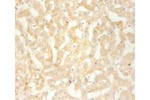 Immunohistochemistry of paraffin-embedded human liver using ABIN7146123 at dilution 1:100 (CXCL13 抗体  (AA 23-95))