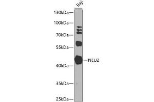 Western blot analysis of extracts of Raji cells, using NEU2 antibody (ABIN6129463, ABIN6144540, ABIN6144541 and ABIN6224161) at 1:1000 dilution. (NEU2 抗体  (AA 171-380))