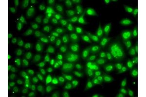 Immunofluorescence analysis of A549 cells using TBL1XR1 antibody. (TBL1XR1 抗体)
