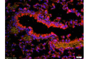 Formalin-fixed and paraffin-embedded rat lung labeled with Anti-Vitamin D Receptor/VDR Polyclonal Antibody, Unconjugated (ABIN682513) 1:200, overnight at 4°C, The secondary antibody was Goat Anti-Rabbit IgG, Cy3 conjugated used at 1:200 dilution for 40 minutes at 37°C. (Vitamin D Receptor 抗体  (AA 65-180))