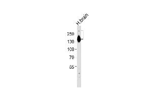 Anti-SPTAN1 Antibody (Center) at 1:2000 dilution + human brain lysates Lysates/proteins at 20 μg per lane. (SPTAN1 抗体  (AA 977-991))