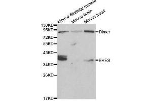 Western blot analysis of extracts of various cell lines, using BVES antibody. (BVES 抗体  (AA 241-360))