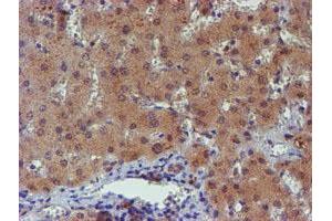 Image no. 9 for anti-Phosphoglucomutase 3 (PGM3) antibody (ABIN1500178)