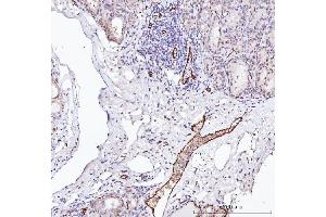 IHC analysis of Von Willebrand Factor/VWF using anti-Von Willebrand Factor/VWF antibody (ABIN7599909).