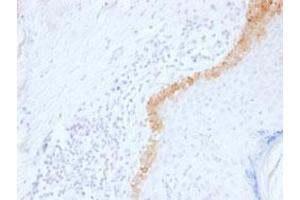 Immunohistochemical staining (Formalin-fixed paraffin-embedded sections) of human skin with KRT15 monoclonal antibody, clone LHK15 .