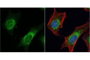 ICC/IF Image Dishevelled 3 antibody [N1N2], N-term detects Dishevelled 3 protein at cytoplasm by immunofluorescent analysis. (DVL3 抗体  (N-Term))