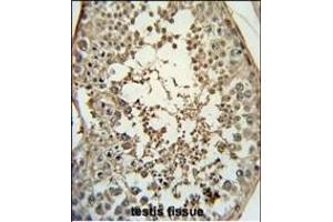 Immunohistochemistry (Paraffin-embedded Sections) (IHC (p)) image for anti-Pro-Melanin-Concentrating Hormone (PMCH) (AA 94-122) antibody (ABIN651719)