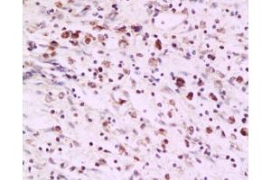 Immunohistochemistry (Paraffin-embedded Sections) (IHC (p)) image for anti-PCNA Clamp Associated Factor (PAF) antibody (ABIN737931)