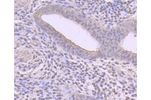 Paraformaldehyde-fixed, paraffin embedded human uterus tissue, Antigen retrieval by boiling in sodium citrate buffer (pH6) for 15min, Block endogenous peroxidase by 3% hydrogen peroxide for 30 minutes, Blocking buffer at 37°C for 20min, Antibody incubation with Cyclin A2 (2E9) Monoclonal Antibody  at 1:50 overnight at 4°C, followed by a conjugated secondary and DAB staining. (Cyclin A 抗体)