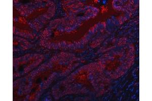 IF analysis of SAP130 using anti-SAP130 antibody (ABIN7601247).