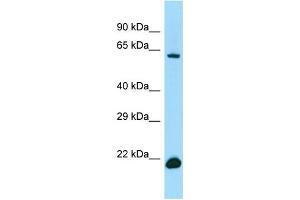 WB Suggested Anti-IRF2BP2 Antibody Titration: 1. (IRF2BP2 抗体  (C-Term))