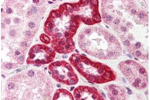 Human Kidney (formalin-fixed, paraffin-embedded) stained with SUMO1 antibody ABIN214521 at 5 ug/ml followed by biotinylated goat anti-rabbit IgG secondary antibody ABIN481713, alkaline phosphatase-streptavidin and chromogen. (SUMO1 抗体  (N-Term))