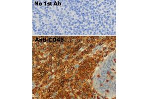 Immunohistochemistry (IHC) image for anti-Protein tyrosine Phosphatase, Receptor Type, C (PTPRC) (C-Term) antibody (ABIN6254211) (CD45 抗体  (C-Term))