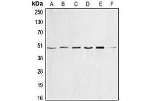 Western blot analysis of Cyclin E1 expression in HEK293T (A), mouse brain (B), PC12 (C), SW626 (D), HeLa (E), K562 (F) whole cell lysates. (Cyclin E1 抗体  (Center))