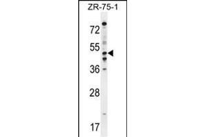 PDE7B Antibody (C-term) (ABIN654632 and ABIN2844328) western blot analysis in ZR-75-1 cell line lysates (35 μg/lane). (PDE7B 抗体  (C-Term))
